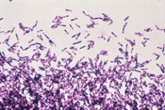 De bacterie clostridium difficile onder de microscoop